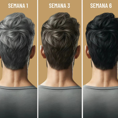 Champú Antiedad y Anticanas